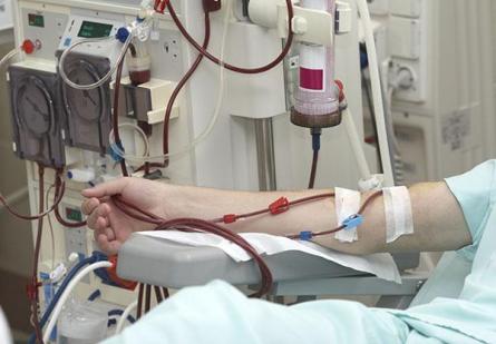 El transplante renal