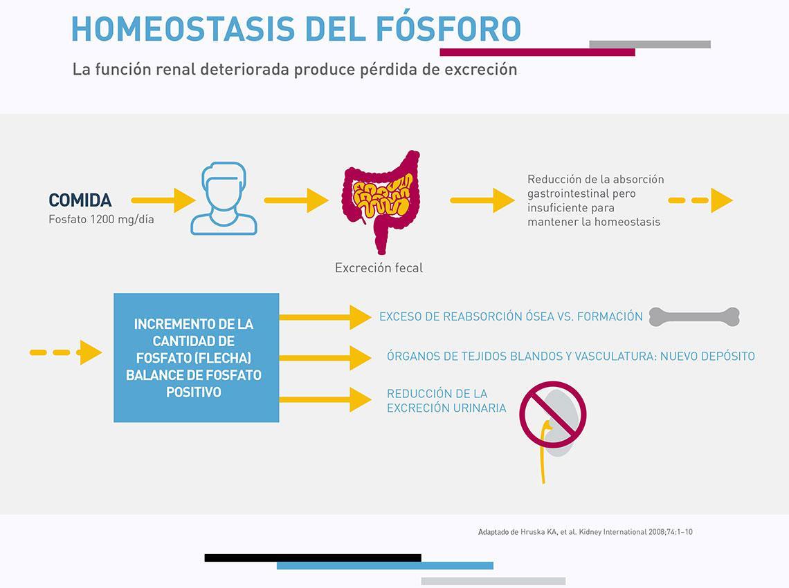 Hiperfosforemia